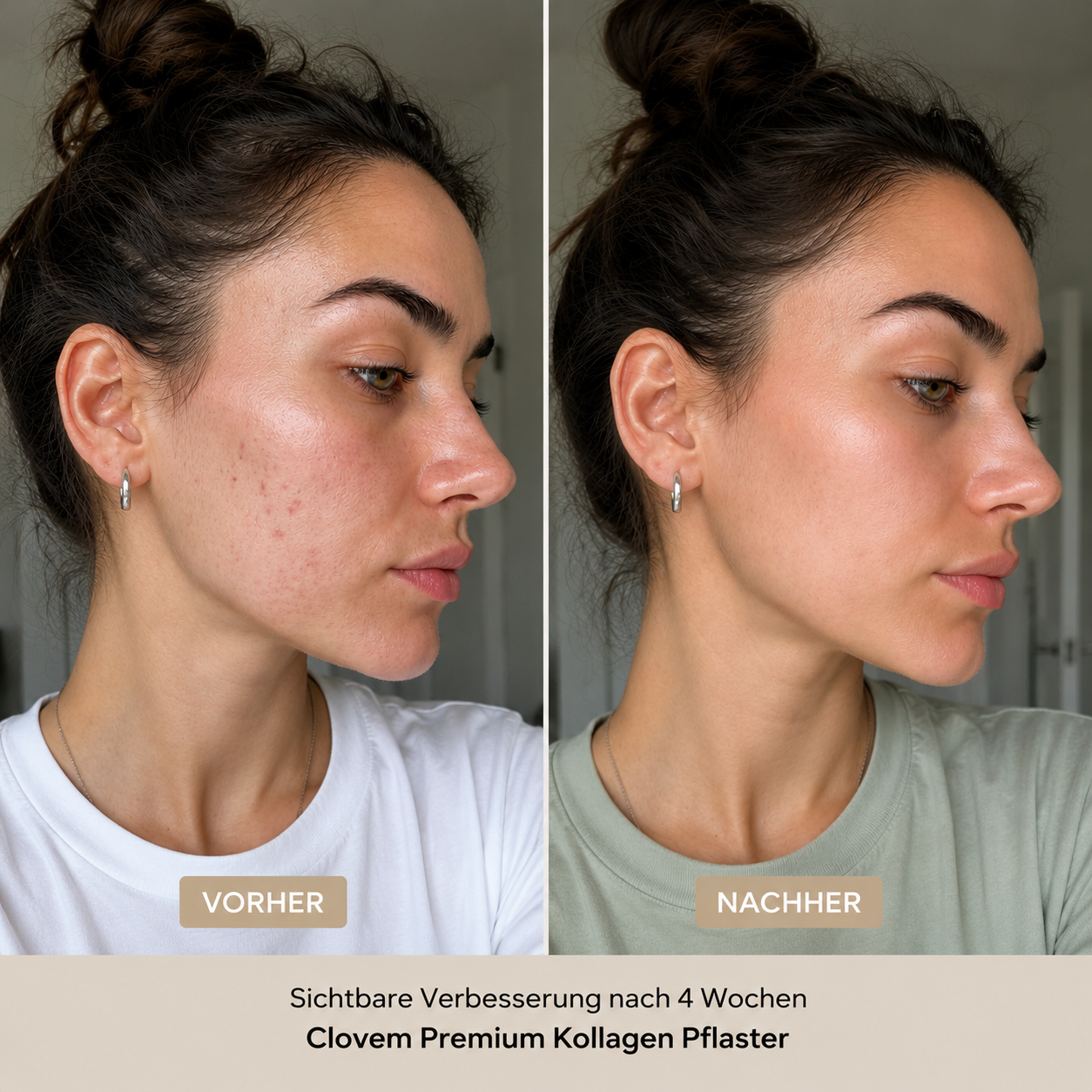 Beauty Skin Patches - Anti Falten Pflaster und Narbenpflaster