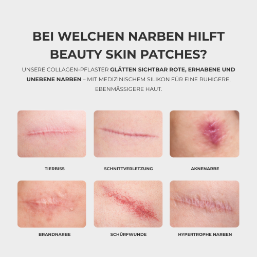 Beauty Skin Patches - Anti Falten Pflaster und Narbenpflaster
