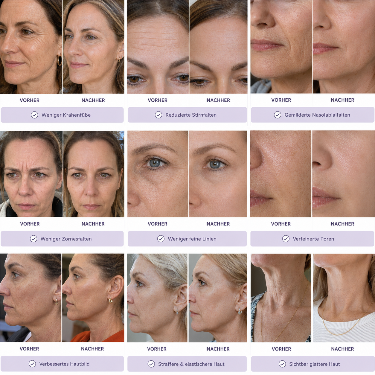 Beauty Skin Patches - Anti Falten Pflaster und Narbenpflaster